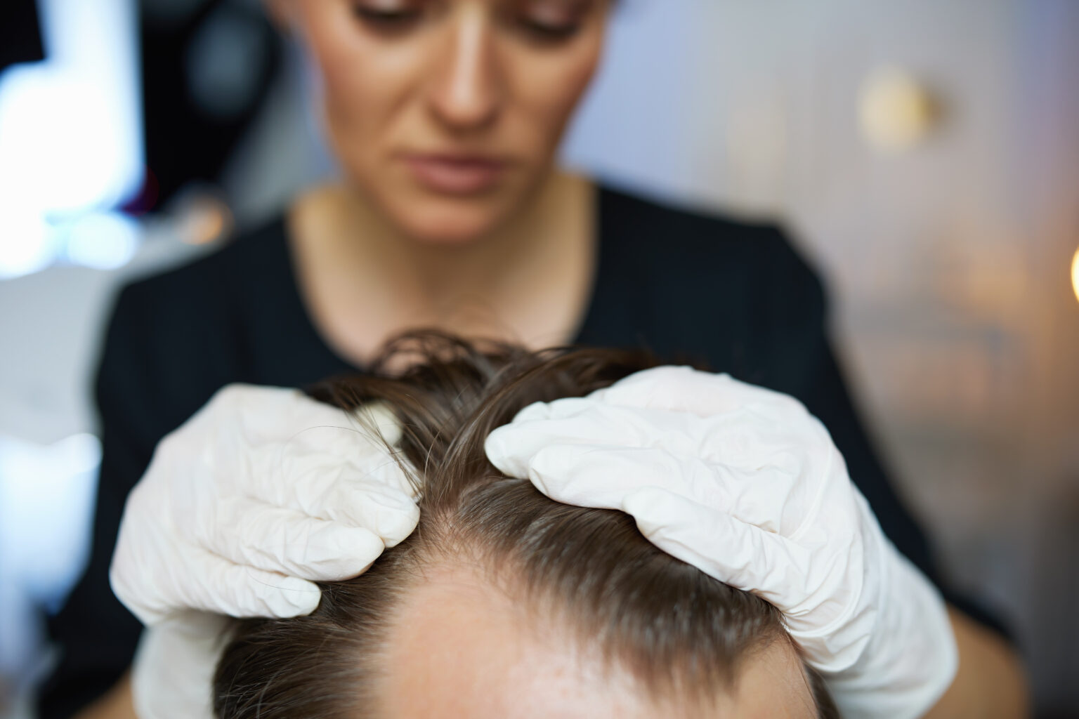 Traitement chute de cheveux