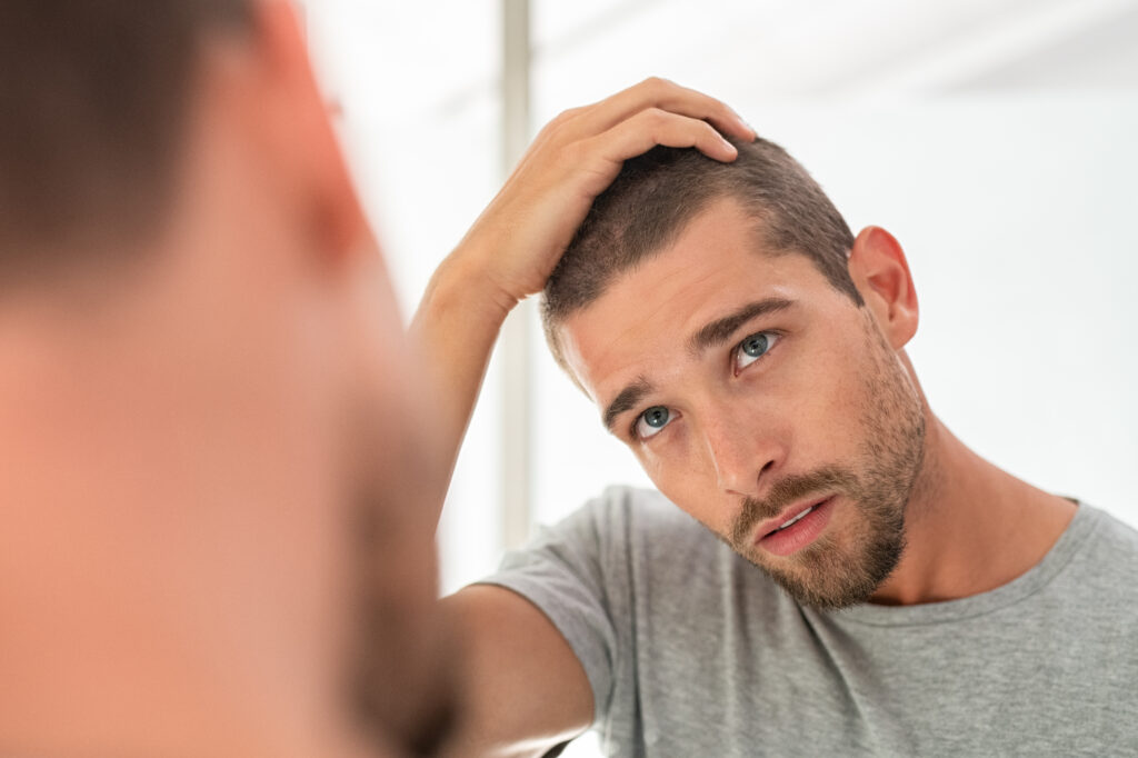 Type d'implantation de cheveux chez l'homme : quelle technique choisir ?